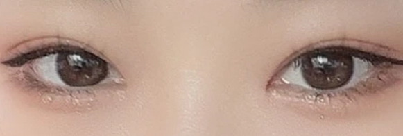 다이아트임 전후사진
